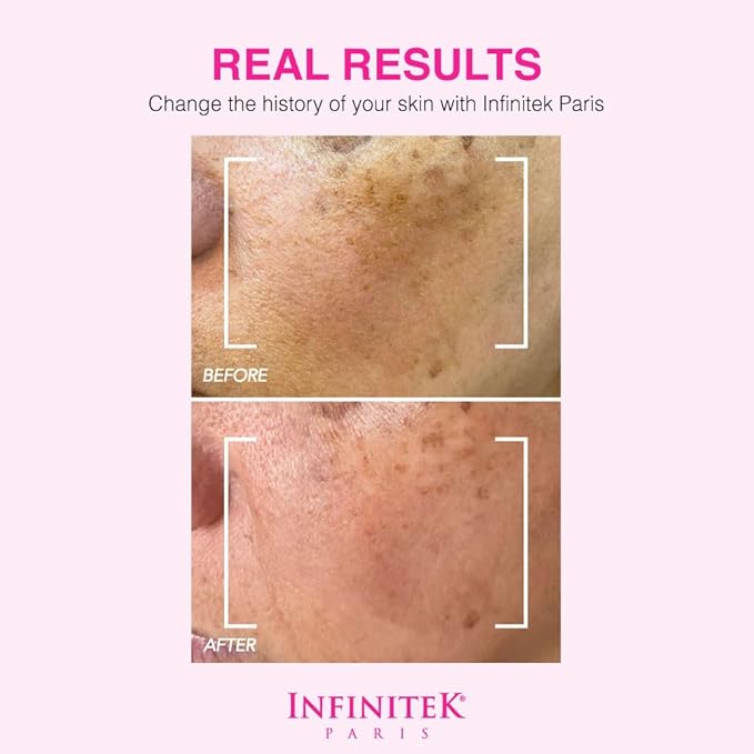 Infinitek Paris Crystal Rose Serum - Hydrating and Exfoliating Brightening Serum, Face Moisturizer and Skin Lightening, Moisturized Skin - Premium Facial Moisturizer 1 Fl Oz