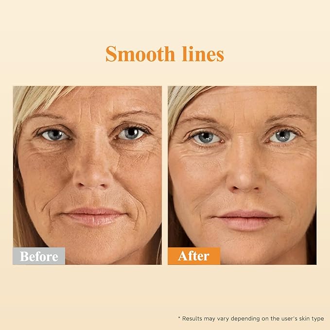 HKH Retinol + HPR Serum for Face - Anti-Aging Wrinkle Night Retinol Capsules, Peptide Serum for Women, Reduce Fine Lines, Tighten Sagging Skin, Fragrance-Free, Alcohol-Free & Non-Greas