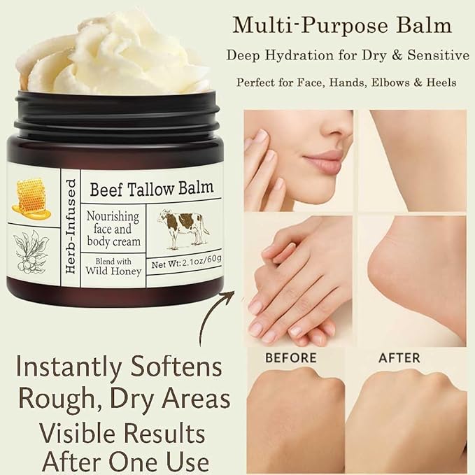 URQT Beef Tallow for Skin - Organic Grass-Fed Whipped Beef Tallow and Honey Balm - Deeply Moisturizing for Face & Body - Natural Skin Care for Soft, Supple Skin