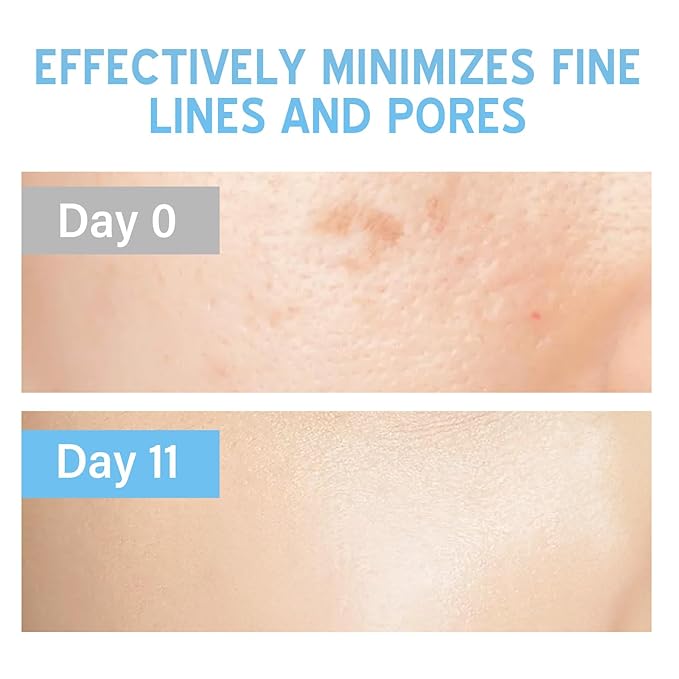 Stem Cell Serum for Face, 2 Count Microneedling Serum, Stem Cell Solution Ampoule to Use with and without Micro Needling, Anti Aging & Smooth Wrinkles