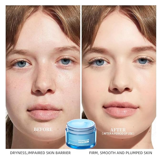Hydro Boost Hyaluronic Acid Moisturizing Water Gel, Face Moisturizer For Oil Skin, Hyaluronic Acid Formula Combined With Water,Lightweight and Long-lasting Hydration-1.76Oz (Water Gel)