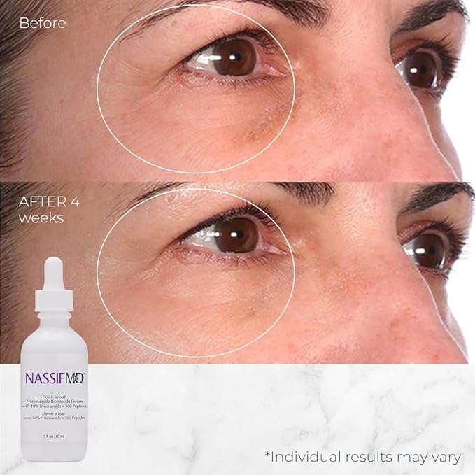 NassifMD Niacinamide Serum 10% with Cranberry Biopeptides and Ectoin, Brightening and Hydrating Vitamin B3 Face Serum, Evens Tone, Smooths Texture, Reduces Fine Lines, Boosts Radiance
