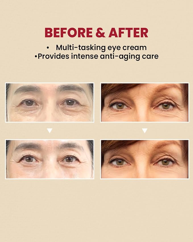 KSECRET SEOUL 1988 Eye Cream : Retinal Liposome 4% + Fermented Bean, 30ml/1.01 fl.oz.