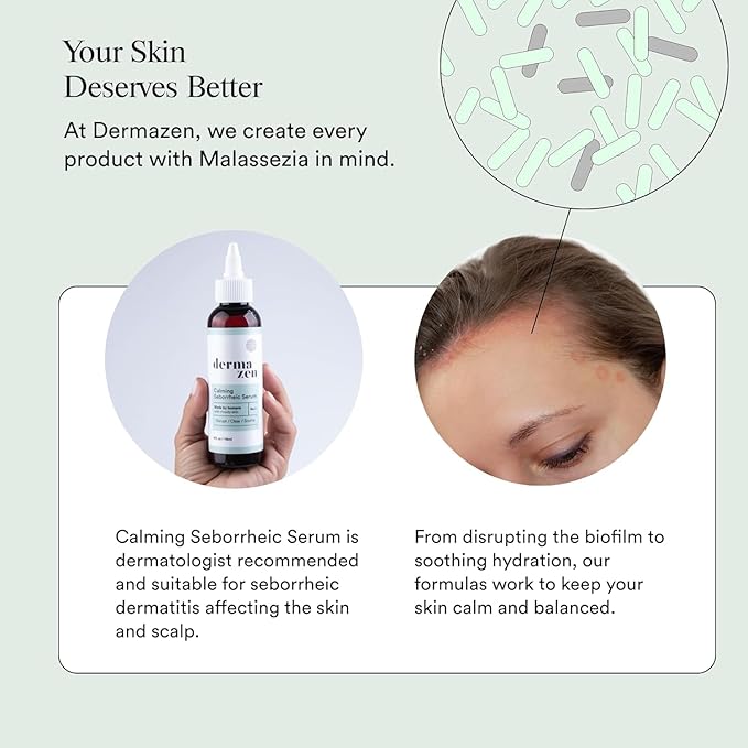 Calming Seborrheic Serum, Dermatologist Recommended, Topical Seborrheic Dermatitis Serum For Scalp, Face, and Body (8 fl oz)