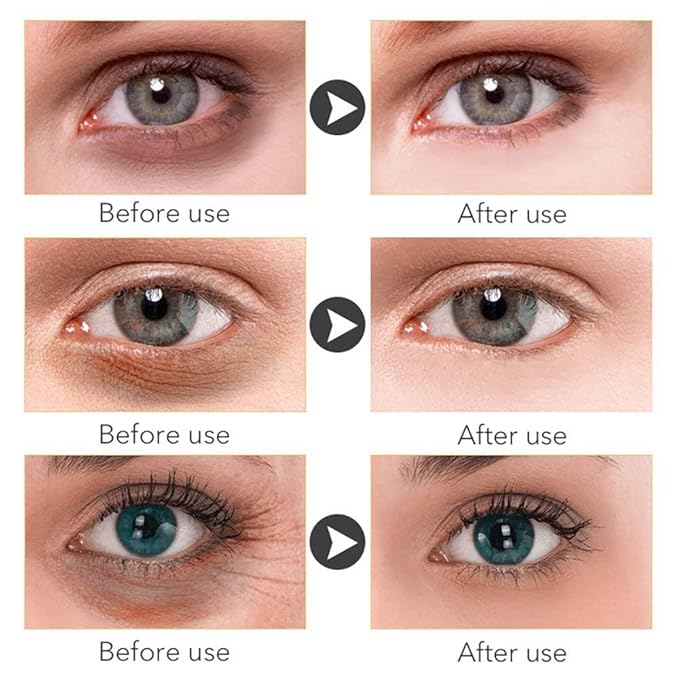 Magic retinol eye cream for