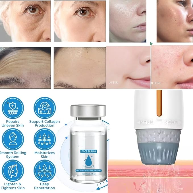Micro in-Fusion System for Face,Facial System with Serum Suitable for All Skin Types(5pcs)