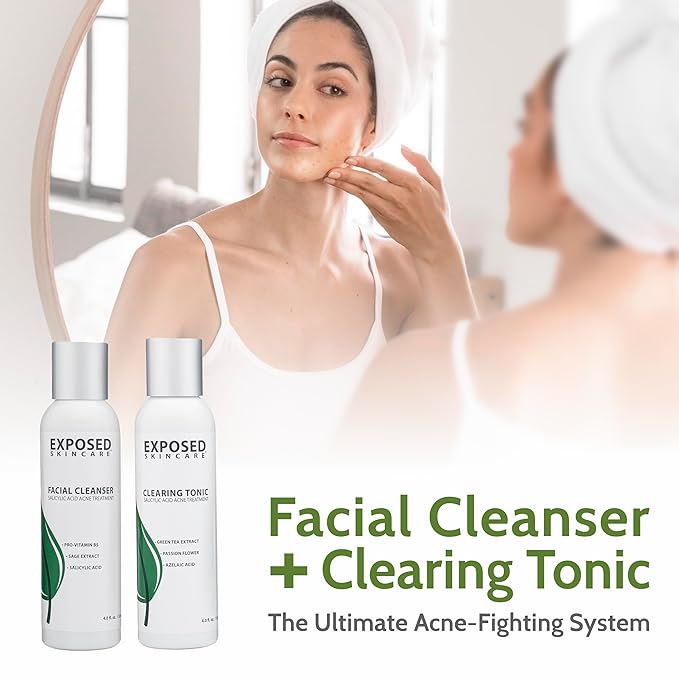 Exposed Skin Care Acne Treatment Kit - Includes Facial Cleanser, Clearing Tonic, Acne Treatment Serum, Clear Pore Serum, Clarifying Mask, Cloth - Natural Acne Solution for Face, All Ages & Skin Types