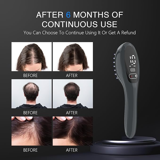 Laser Therapy Hair Growth Comb, Red Light Therapy for Hair Growth, FDA Cleared Laser Comb System, Hair Loss, Hair Thinning & Alopecia Treatment for Men & Women Homeuse