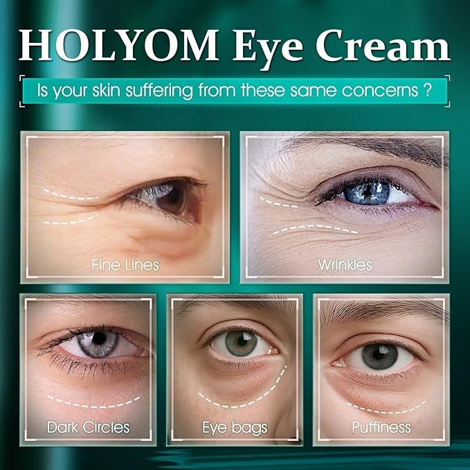 Advanced Eye Cream for Dark Circles - Targeted Solution for Wrinkles, Puffiness, and Firmness - Proven Efficacy with Cynanchum Atratum, and Natural Infusions (30ml)