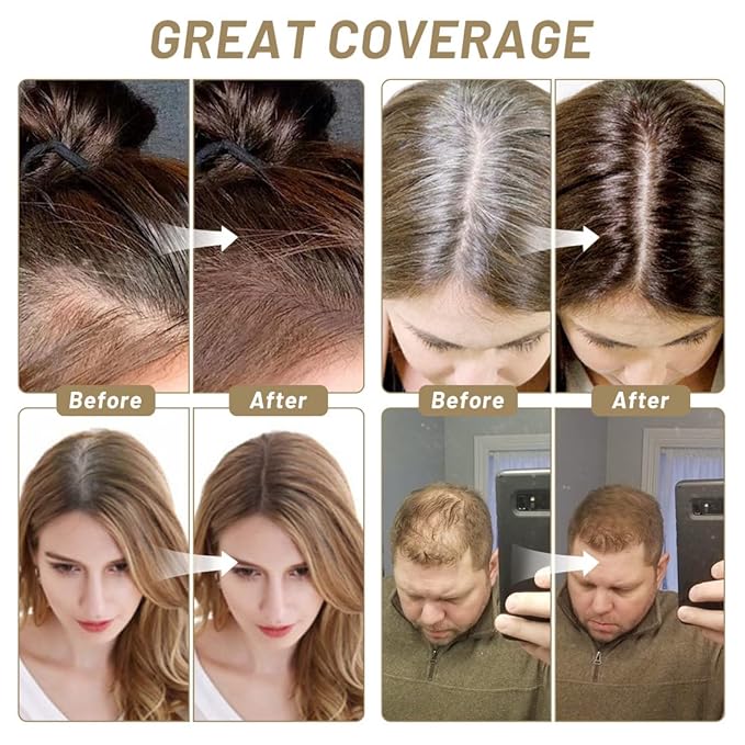 SOVONCARE Instantly Hairline Powder, Hairline