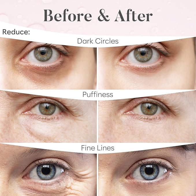Rose eye mask (30 pairs)