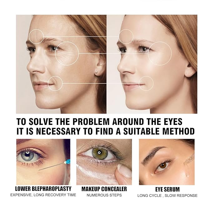 Eye cream, caffeine under eye