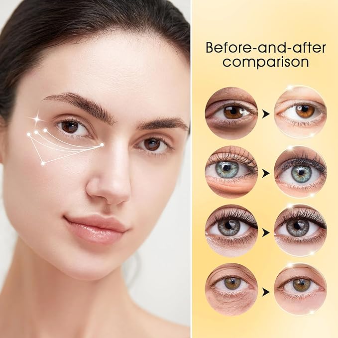 Adofect 30 paris under eye