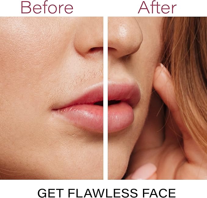 Facial Hair Removal for Women | Electric Razor Device Small Mustache Dermaplaning Remover Tools Tweezers Epilator Trimmer Face Dermaplane Shavers Beauty Gadgets Set Accessories by VISOFO (RoseQuartz)