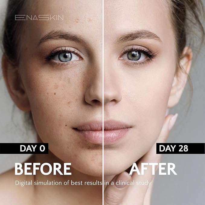 EnaSkin Dark Spot Remover for Face and Body: Advanced Formula Spot Corrector Cream to Fade Age Spots, Sun Spots, Freckles, Melasma, and Brown Spots for Women and Men (1.7 Oz)