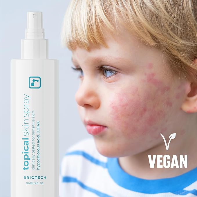 BRIOTECH Topical Skin Spray, Hypochlorous Acid for Body & Face, Eyelid Cleanser, HOCl Facial Mist, Support Against Irritation, Calm Redness, Soothe Foot & Scalp, 1 Liter Refill, 1 ct