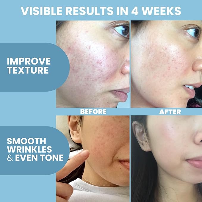 Collagen Peptide - Anti Aging Collagen Serum for Face, Skin Brightening, Reduces Fine Lines & Wrinkles, Heals and Repairs Skin, Microneedling with Hyaluronic Acid (2 oz)