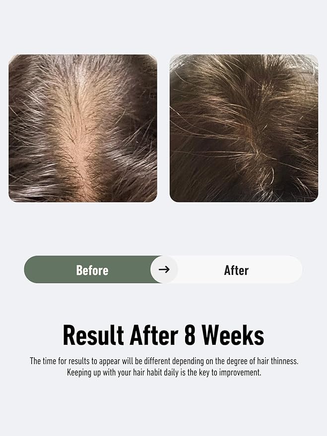 S2 Scalp Serum - Promotes Healthy Scalp, Thicker and Fuller-Looking Hair, Nourishes and Balances Scalp Environment, Vegan and Non-Greasy - 2 fl oz