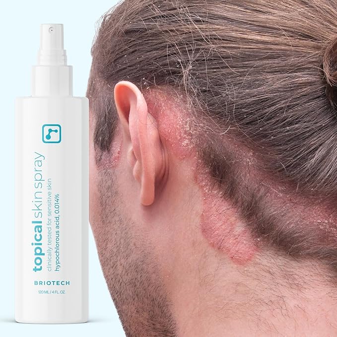BRIOTECH Topical Skin Spray, Hypochlorous Acid for Body & Face, Eyelid Cleanser, HOCl Facial Mist, Support Against Irritation, Calm Redness, Soothe Foot & Scalp, 1 Liter Refill, 1 ct