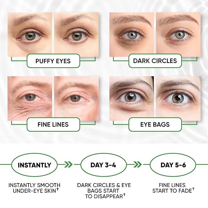 Under Eye Mask for Puffy