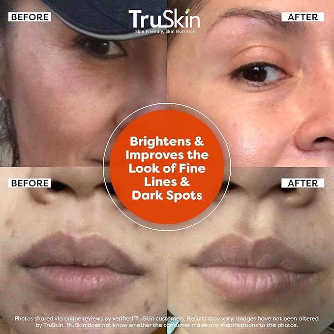 TruSkin Vitamin C Serum For Face – Anti Aging Formula with Vitamin C, Hyaluronic Acid, Vitamin E – Brightening Serum – Improve Appearance of Dark Spots, Tone, Fine Lines & Wrinkles, 2 Fl Oz