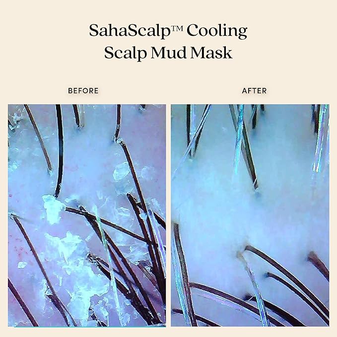 Fable & Mane Cooling Scalp Mud Mask, Soothes Itchiness and irritation. Treatment to Purify the Scalp with Ayurvedic Neem