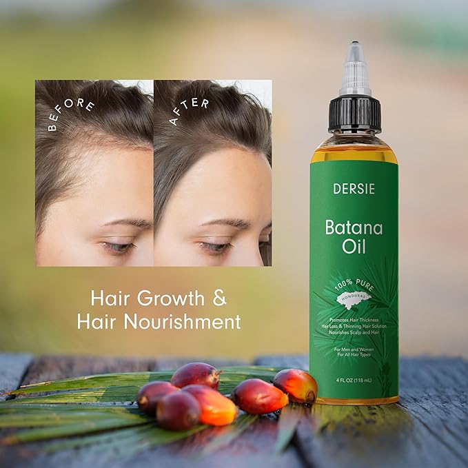 (Pack of 2) Batana Oil for Hair Growth: Dr Sebi Organic Raw Batana Oil from Honduras - 100% Pure & Natural - For Thicker & Stronger Hair - 4 FL OZ Per Bottle