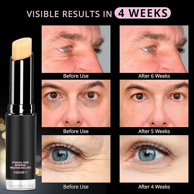 Retinol eye stick, retinol eye