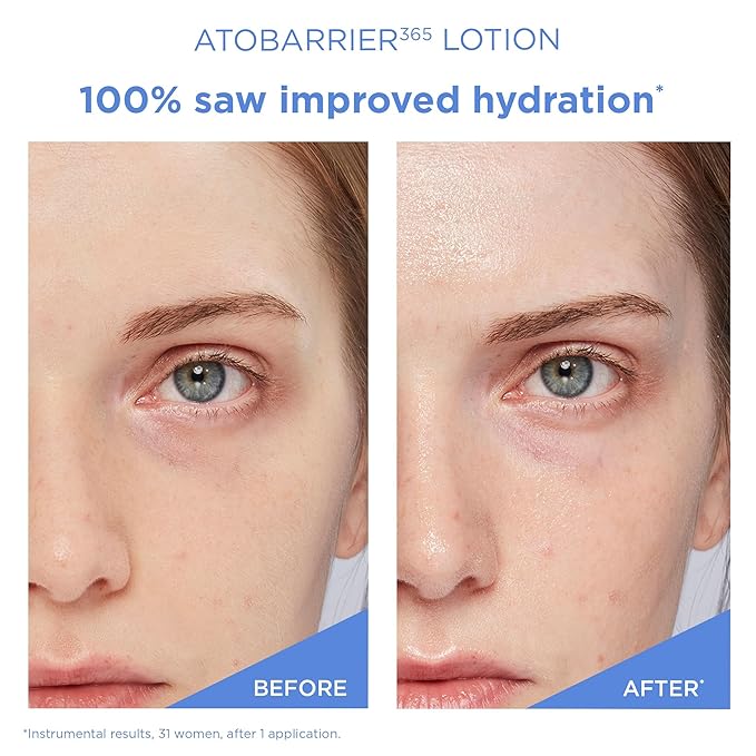 AESTURA ATOBARRIER365 Lightweight Korean Facial Moisturizer Lotion with Ceramides | Fast-Absorbing Hydration, Strengthens Skin Barrier, Suitable for Dry, Normal & Sensitive Skin, 150ML / 5.07 fl. Oz.