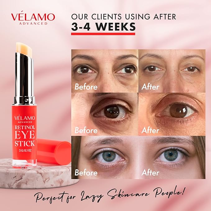Retinol Eye Stick, Retinol Eye Cream, Retinol Cream, Retinol Face Cream, Under Eye Cream Anti Aging, Eye Cream, Brightening Eye Balm Reduces Fine Lines and Dark Circles, Visible Results in 3-4 Weeks