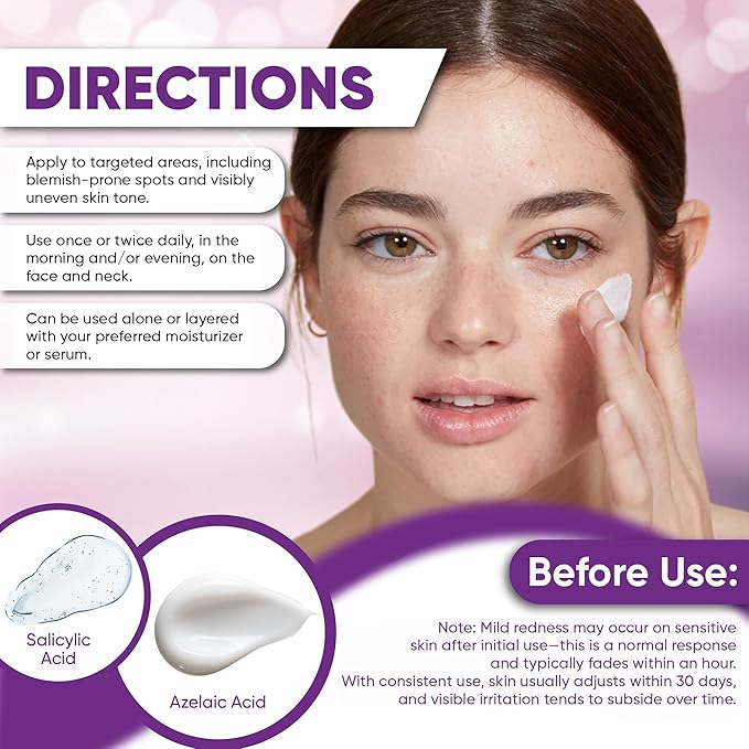 Azelaic Acid Acne Cream: Azelaic Acid For Face - Premium Azelaic Acid Cream - Face Skin and Beauty Care - Azelaic Acid Facial Cream, 1 Oz