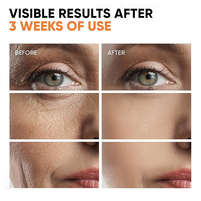 Vitamin C Serum for Face with Hyaluronic Acid, Niacinamide, Vitamin E, Collagen Peptides - Skin Brightening Solution for Wrinkles, Dark Spots, Fine Lines - Anti Aging Stem Cell Serum for Face - 1 oz