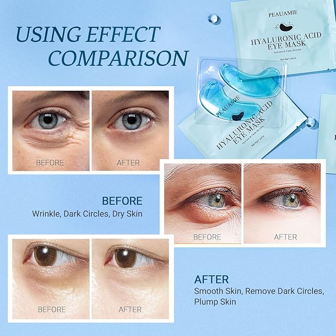 Under eye patchs (30 pairs)