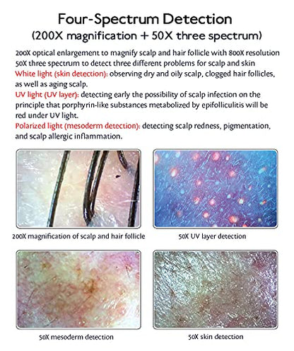 Skin Hair Scalp Detector Hair Follicle Facial Skin Oil Moisture 11 Inch HD LCD Screen Microscope Tester
