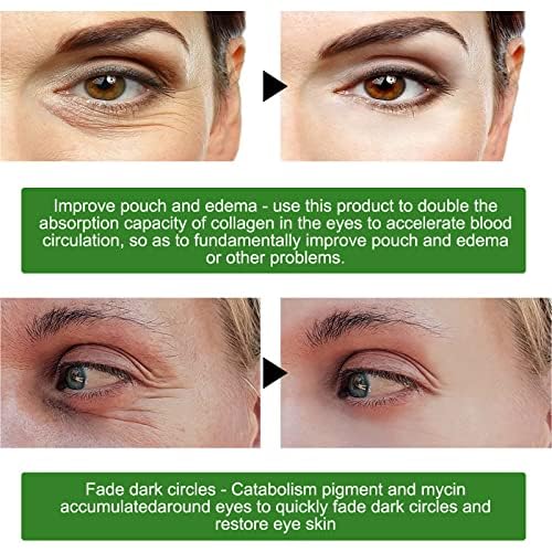 Fivewan aloe vera under eye