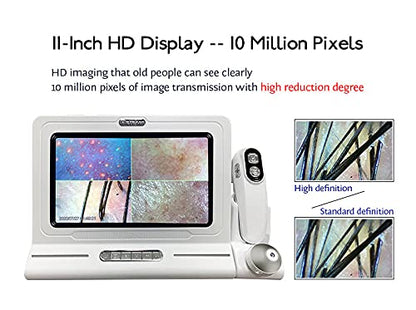 Skin Hair Scalp Detector Hair Follicle Facial Skin Oil Moisture 11 Inch HD LCD Screen Microscope Tester