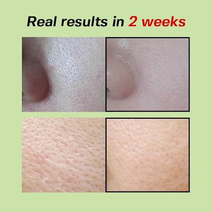 SUNGBOON EDITOR Green Tomato Pore Lifting Ampoule | Pore Minimizer Serum with Niacinamide & Green Tomato Extract | Hydrating & Firming Care for Sensitive Skin | Korean Skincare
