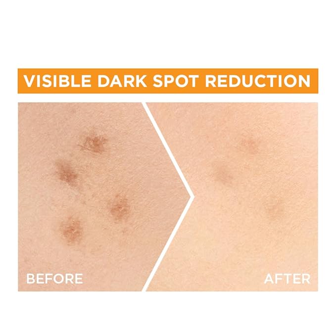 Garnier Bright Complete VITAMIN C Booster Face Serum, 30ml