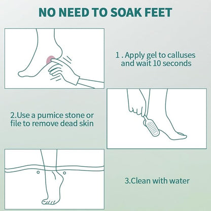 Gorgellux callus remover gel, callus