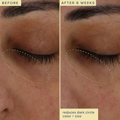 Farmacy Brightening Eye Cream - Wake Up Honey Under Eye Cream for Dark Circles + Puffiness - Enriched with Vitamin C + Cranberry Peptide to Smooth Wrinkles Over Time (15ml)