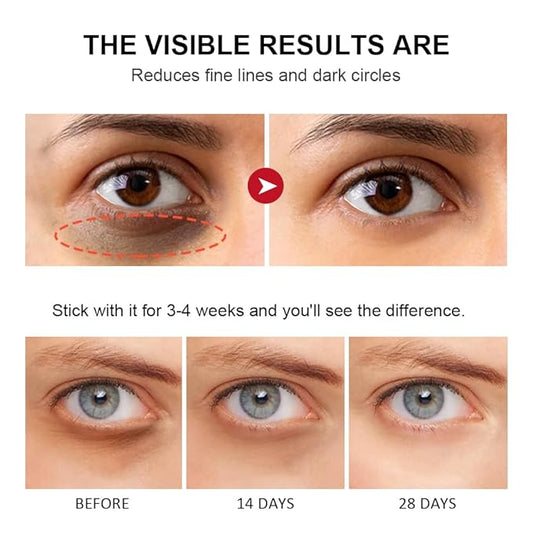 Retinol eye stick-peace out dark