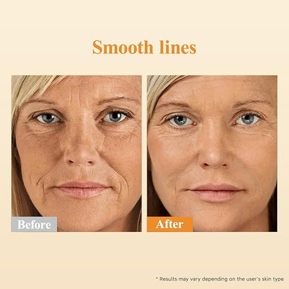 HKH Retinol + HPR Serum for Face - Anti-Aging Wrinkle Night Retinol Capsules, Peptide Serum for Women, Reduce Fine Lines, Tighten Sagging Skin, Fragrance-Free, Alcohol-Free & Non-Greas