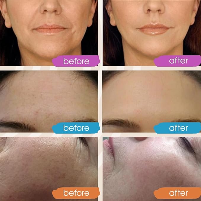 Retinol Serum for Face, Vitamin C with Hyaluronic Acid Face Serum for Women and Men, Glow Skin Care Set Total Package Targets Appearance of Uneven Skin Tone and Dryness 3x1oz