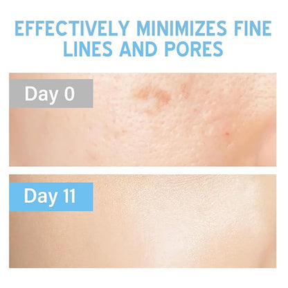 Stem Cell Serum for Face, 2 Count Microneedling Serum, Stem Cell Solution Ampoule to Use with and without Micro Needling, Anti Aging & Smooth Wrinkles