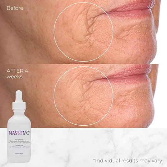 NassifMD Niacinamide Serum 10% with Cranberry Biopeptides and Ectoin, Brightening and Hydrating Vitamin B3 Face Serum, Evens Tone, Smooths Texture, Reduces Fine Lines, Boosts Radiance