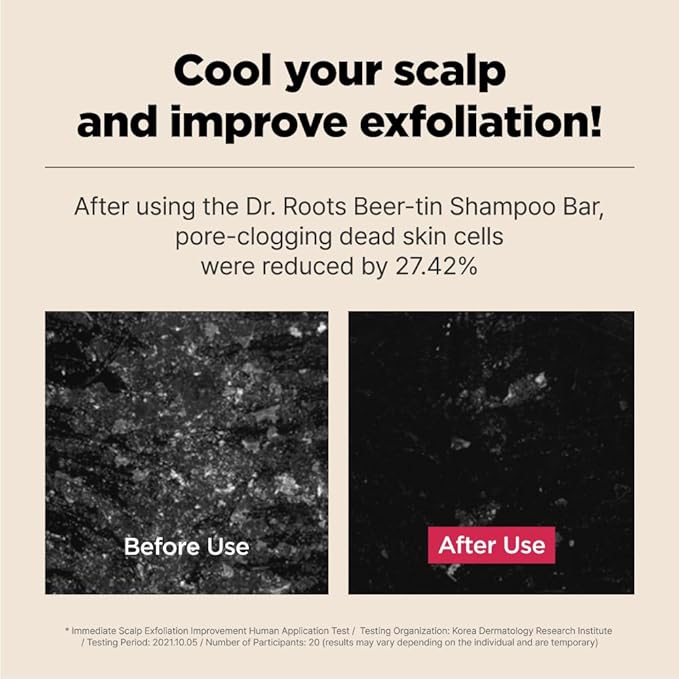ISOI Dr. Roots Beer-Tin Solid Shampoo Bar, Nourishing & Strengthening Shampoo Bar with Beer Yeast & Biotin, Plastic-Free Clean Beauty, Korean Hair Care (3.52 oz, 100g)