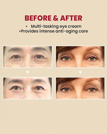 KSECRET SEOUL 1988 Eye Cream : Retinal Liposome 4% + Fermented Bean, 30ml/1.01 fl.oz.
