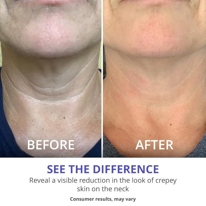 goPure Tighten and Lift Neck Cream - Clinically Tested - Pack of 2