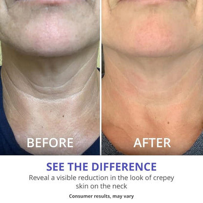 goPure Tighten and Lift Neck Cream - Clinically Tested - Pack of 2