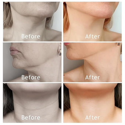 Neck Wrinkle Patches, High Elastic Anti Wrinkle Patches for Lifting Loose Skin, Improve Neck Fine Lines & Wrinkles, Pink